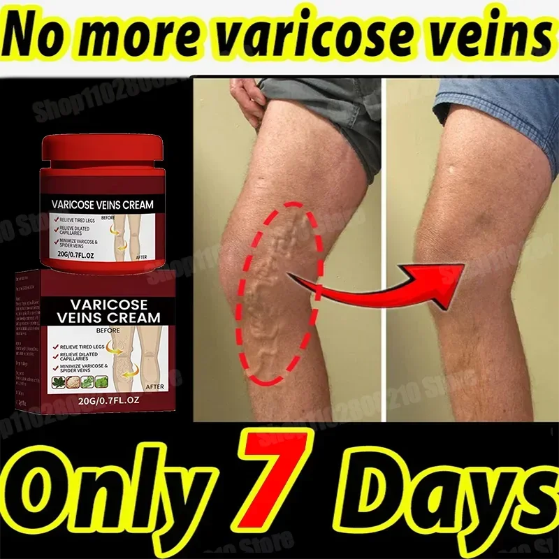 Privates Антибактериальный крем Мошонка Экзема Щедрый Кририс Грибковое инфекция