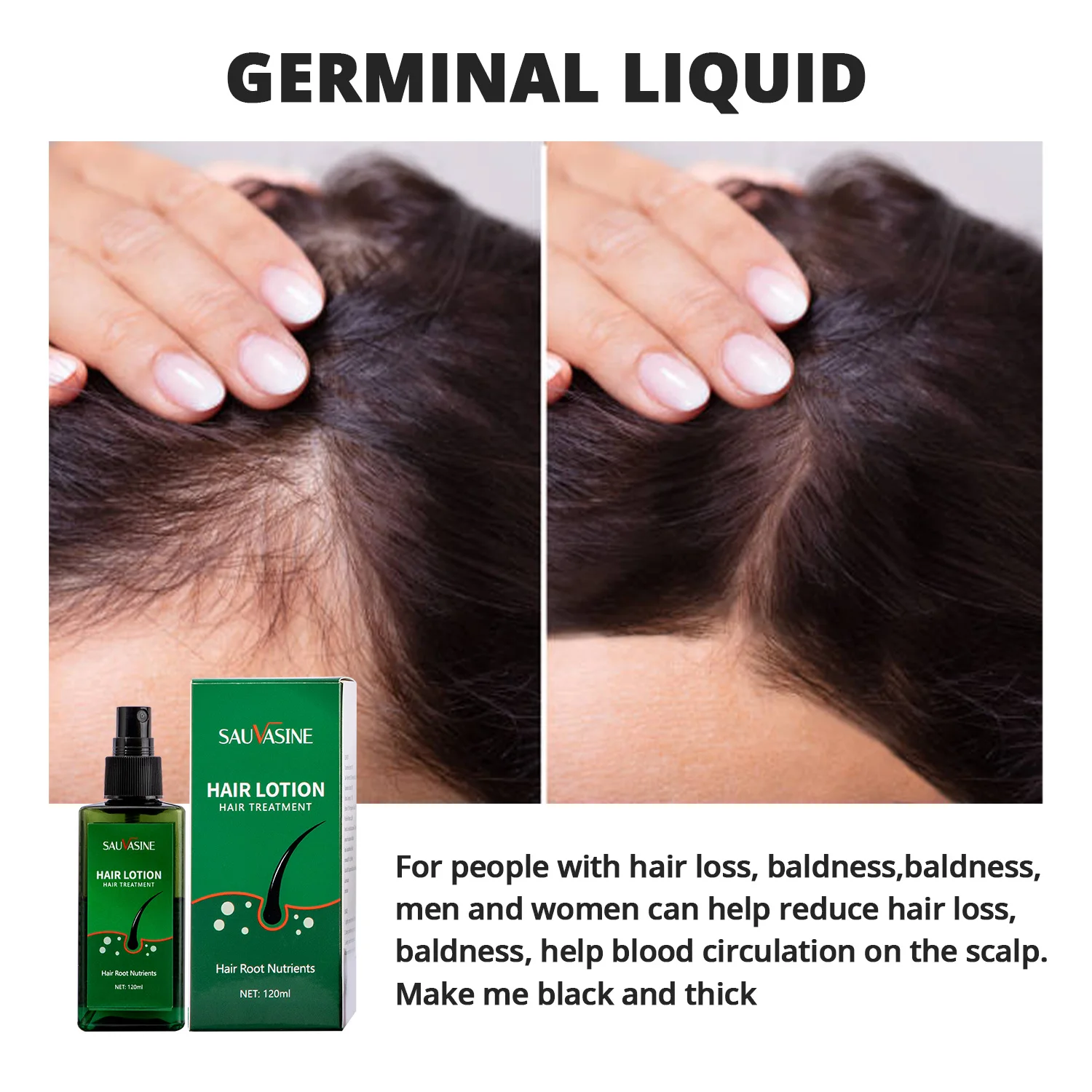 

Natural Hair Growth Essence Thickener Regrowth Serum Treatments Oil Fast Grow Hair for Hair Loss Care Products Men & Women