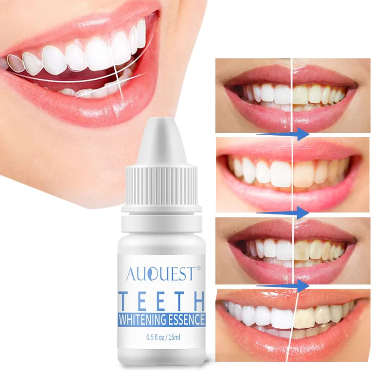 

Tooth Gel Foreign Trade Source of Brightening Teeth Beauty Tooth Liquid, Improving Yellow Teeth, Removing Stains, Dental Care
