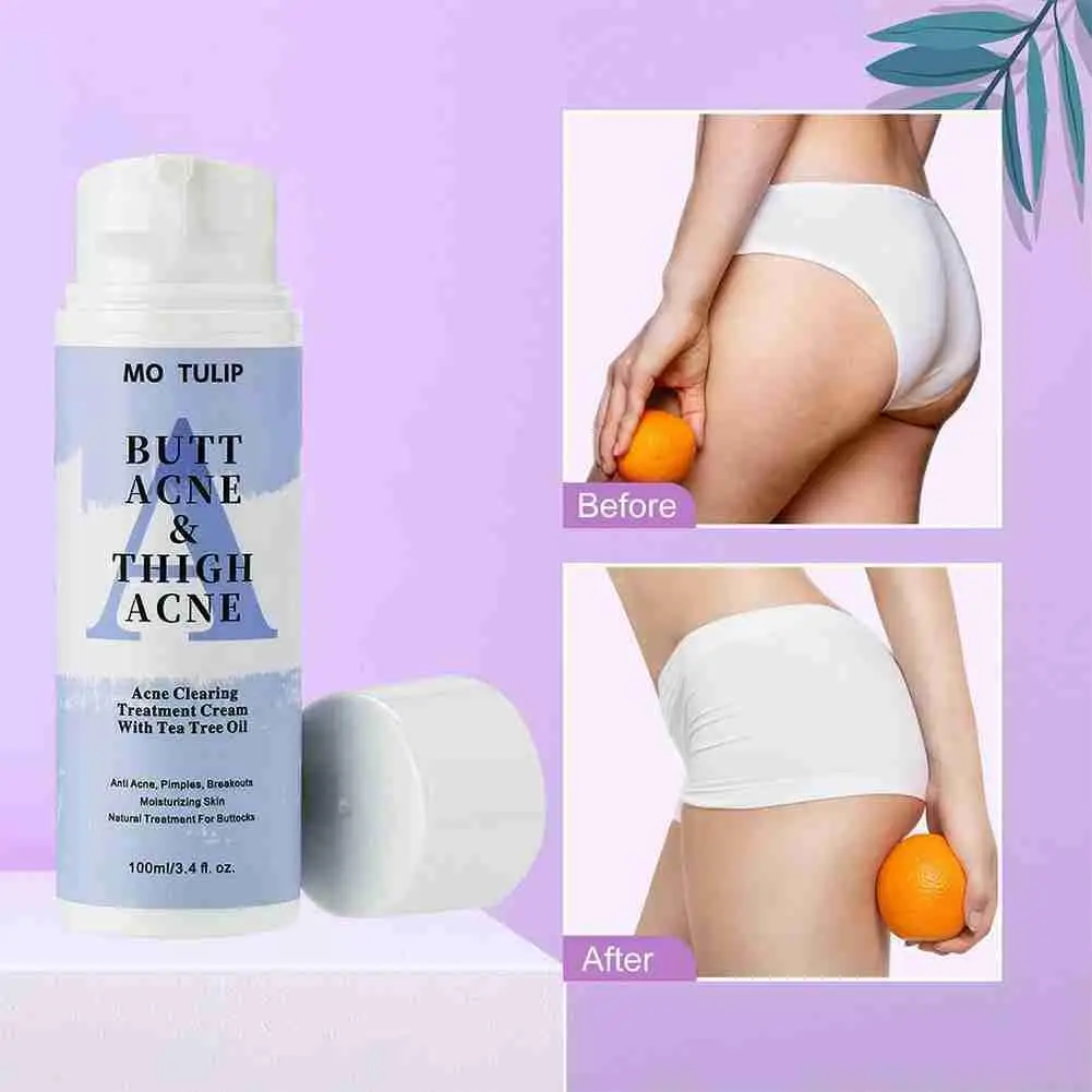 

Butt Acne Clearing Spot Treatment Cream Clears Acne Pimples Zits Razor Bumps and Dark Spots for the Buttocks and Thigh Area 100g
