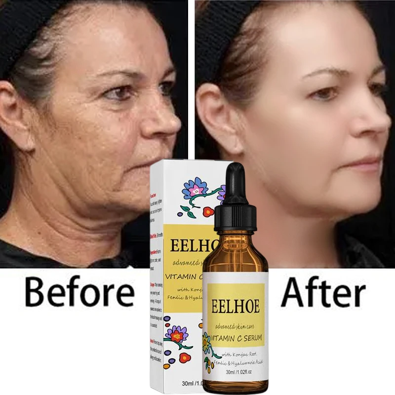 

Wrinkle Remove Serum Anti-Aging Fade Fine Line Lifting Firming Face Essence Whitening Moisturizing Repairing Skin Korea Cosmetic