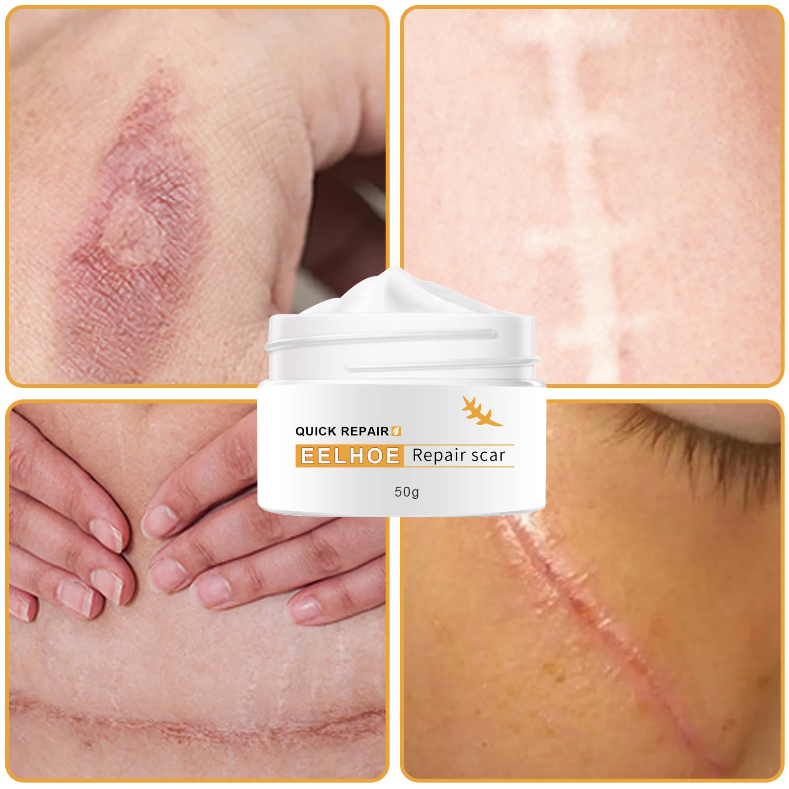 

Skin Repair Ointment Skin Wound Ointment Scalding Desalination Ointment Surgical Scar Repair Ointment Scar Repair and Dilution
