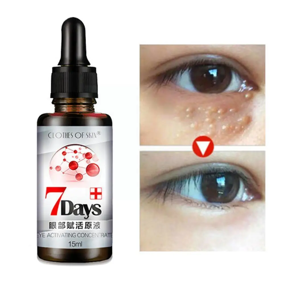 

Natural Eye Serum Cream 7 Days Remove Dark Circle Bags Fat Prevent The Improve Particles Under And Eyes Skin Improve Appear E5r3