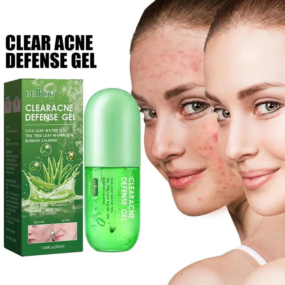 

Aloe Vera Gel ClearAcne Defense Treatment Remove Acne Care Body Sunburn Skin Scar Repair Cream Day Moisturizer