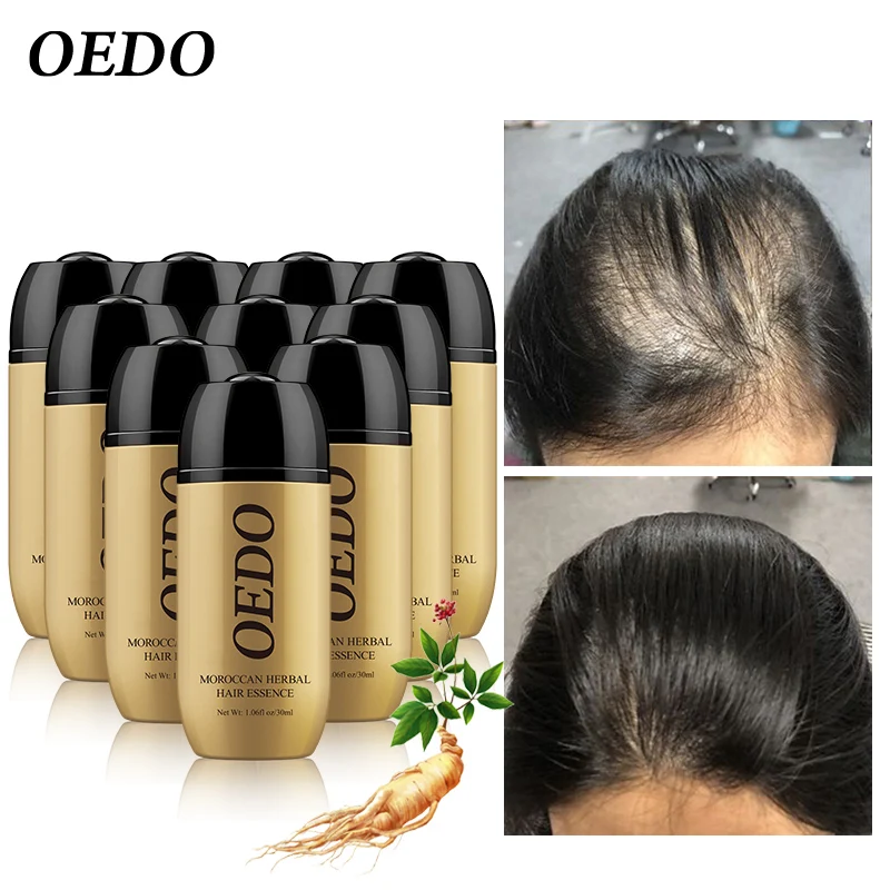 10PCS/lots Ginseng Multi-functional Nourishing Repair Hair For Hair Loss Fast Powerful Hair Growth Serum Repair Hair Root