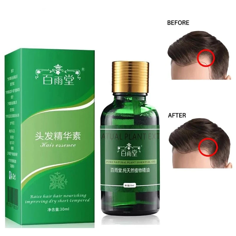 

30ml Hair Growth Essential Oil Original Herbal Essence Anti-hair Loss Liquid Hair Growth Dense Essence Hair Growth Products