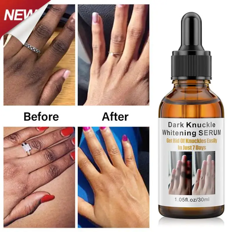 

Улучшенная Формула для отбеливания суставов, коррекция пигментации, улучшение текстуры, отбеливание и чернение