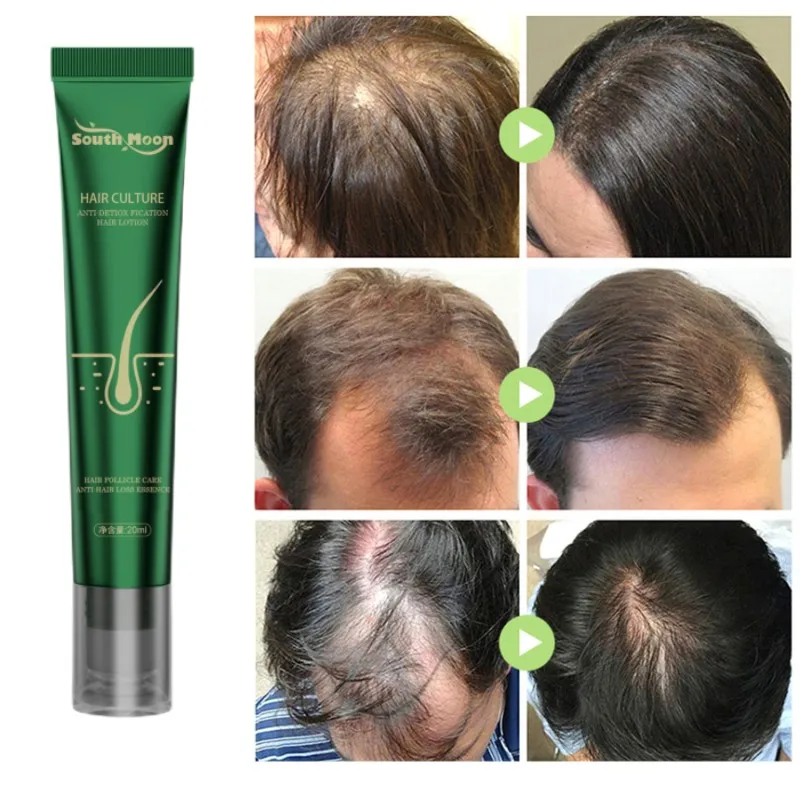 Biotin Instant Hair Growth Oil Hair Growth Essence Anti-Hair Loss Hair Regrowth Serum Hair Thinning Treatment For Women & Men