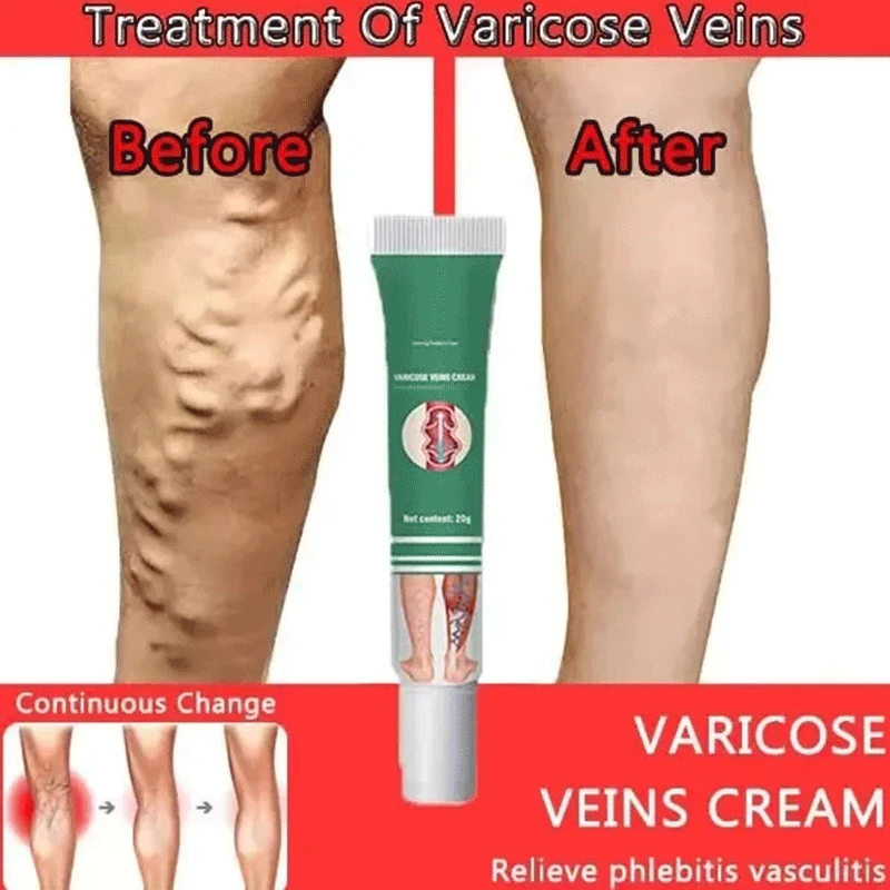 Крем для ног с рисунком паутины