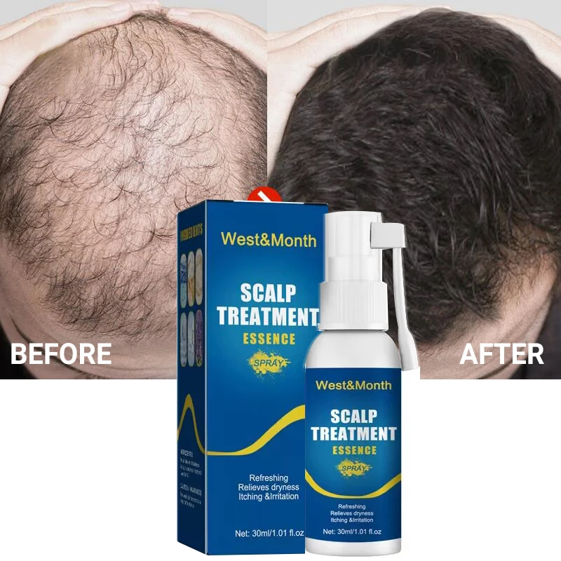 Hair Growth Products Fast Growing Hair Serum Spray Anti Hair Loss Treatment Essence Oil Repair Nourish Hair Roots For Men Women