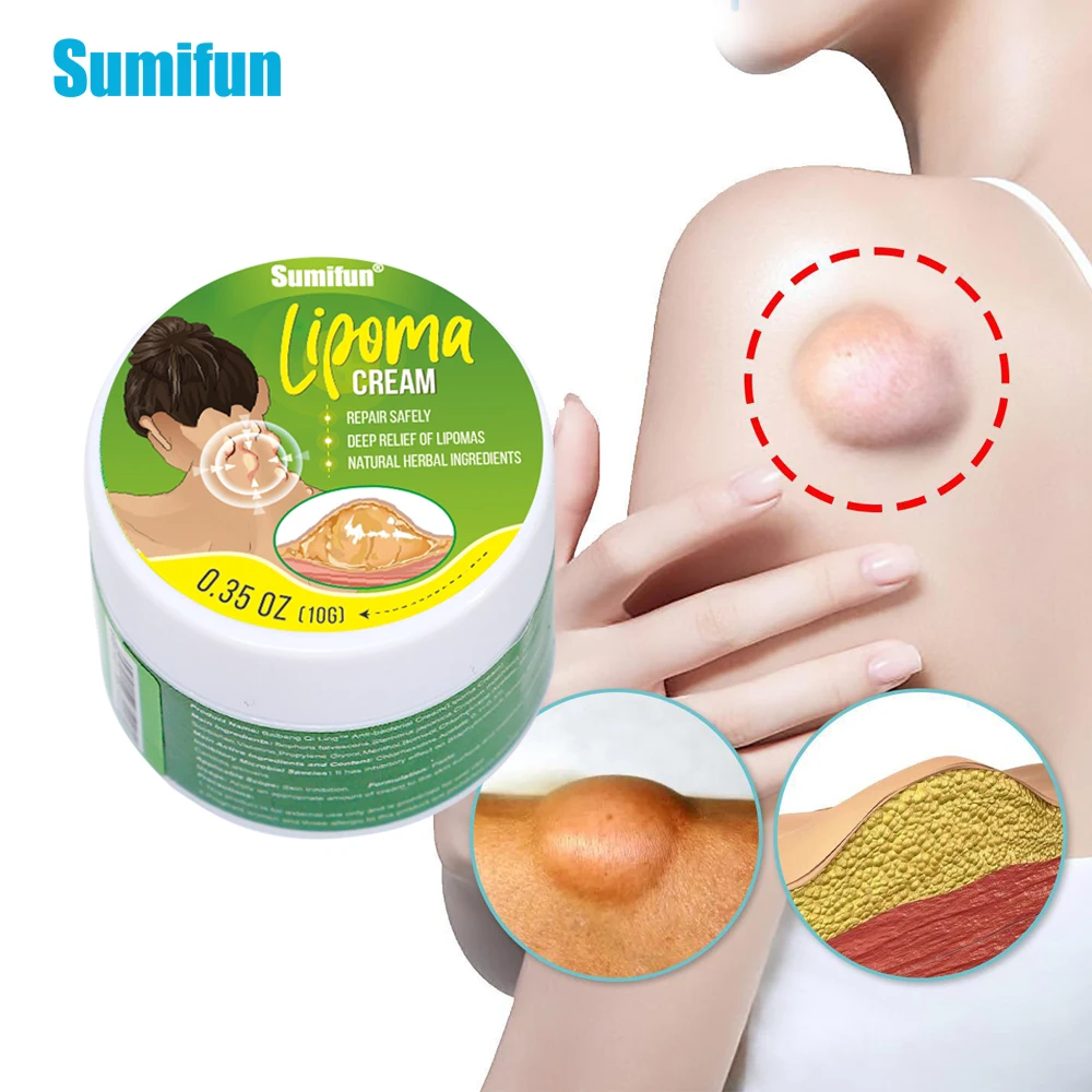 

Крем Lipoma Sumifun 20 г для удаления нодулярного дискомфорта, опухолей и отеков кожи, противоопухолевой жир, медицинский пластырь