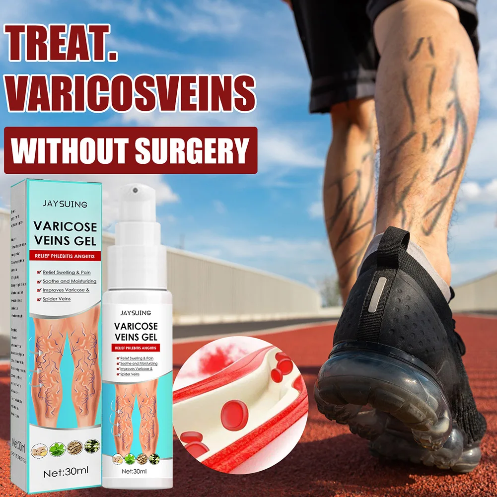 

30ml Varicose Veins Gel Treatment Cream Relieve Legs Pain Earthworm Dilated Vasculitis Phlebitis Spider Pain Veins Ointment