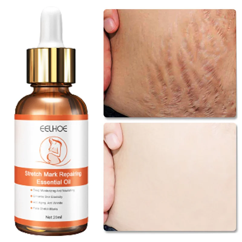 

Stretch Marks Permanent Removal Oil Maternity Pregnant Women Pregnancy Scar Deep Repair Cream Anti Winkle Firming Body Skin Care