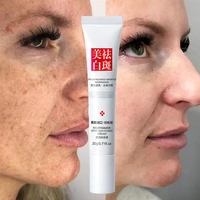 freckle cream whitening effective remove melanin dark spots pigmentation melasma brighten gel anti aging face freckle skin care