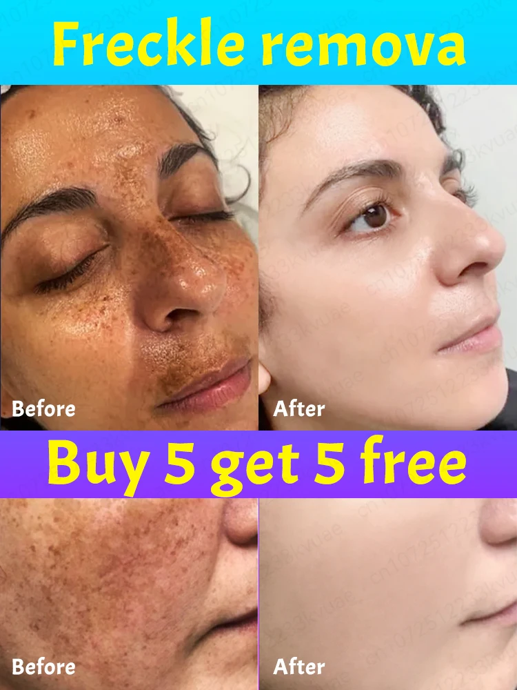 ʸ ᵒᵉ ᵉ ᵒ ˢ ᵃᵃᵃᵃᵃᵃᵃᵃ