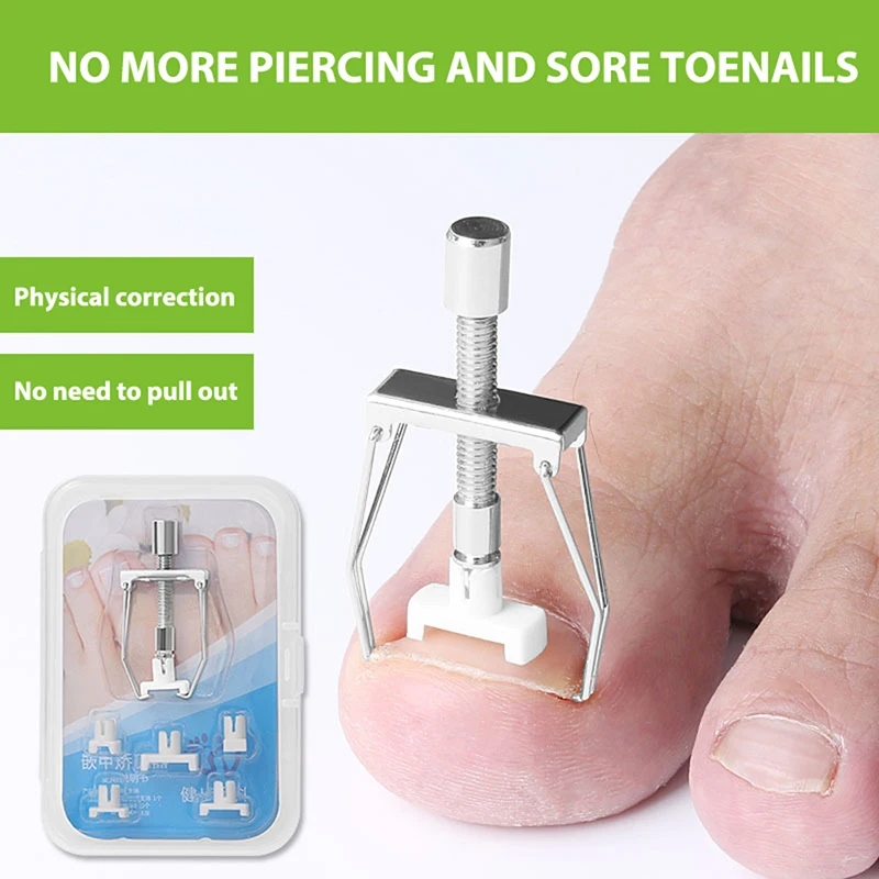 

Adjustable Ingrown Toe Nail Recover Correction Pedicure Toenail Fixer Foot Nail Care Tool Orthotic Nail Corrector Pedicure Tool