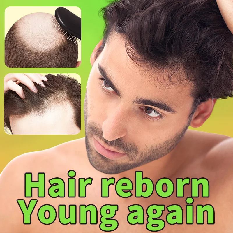 

Fast Hair Growth for Men Polygonum Herbal Extracts Anti-Hair Loss Serum Rescue Hairline Baldness Follicle Treatment Hair Care