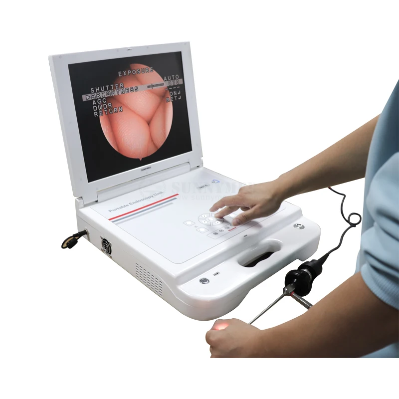 

SY-PS045N 4 in 1 High Brightness Portable Endoscopy Unit Hysteroscopic System