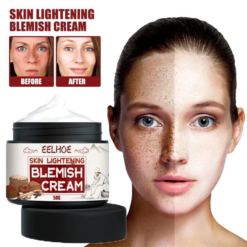 

Effective Whitening Freckle Cream Remove Melasma Acne Dark Spots Fade Pigment Melanin Corrector Moisturizing Brighten Skin Care