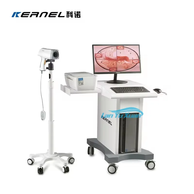 KN 2200 Полностью цифровой видеокольпоскоп Портативная система кольпоскопии