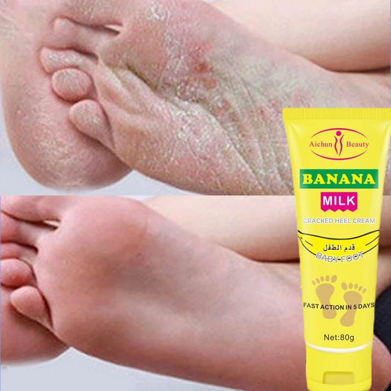 

Banana Body Skin Foot Care Cream Repair Anti-drying Anti-cracking Moisturizing Exfoliating Heel Mask Removal Callus Whitening