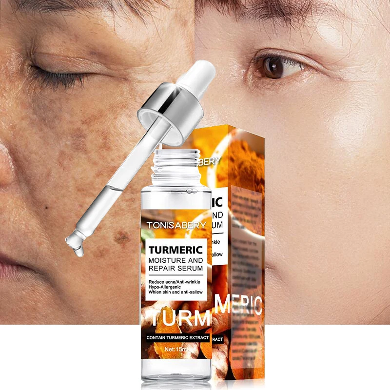 

Turmeric Whitening Freckle Removal Face Serum Lighten Dark Spots Melanin Chloasma Improve Dullness Anti-aging Wrinkle Skin Care