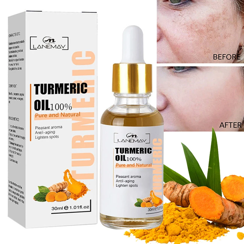 

Turmeric Freckle Whitening Serum Fade Dark Spots Remove Pigmentment Melanin Correcting Face Essence Beauty Skin Care Products