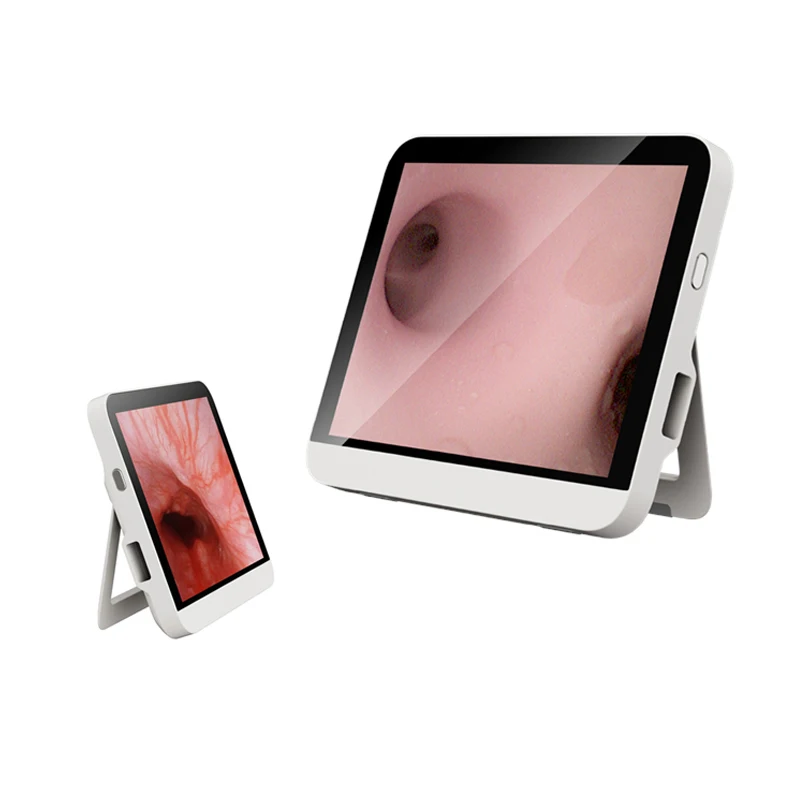 Euprun одноразовый цифровой портативный гибкий бронхоскоп цена видео