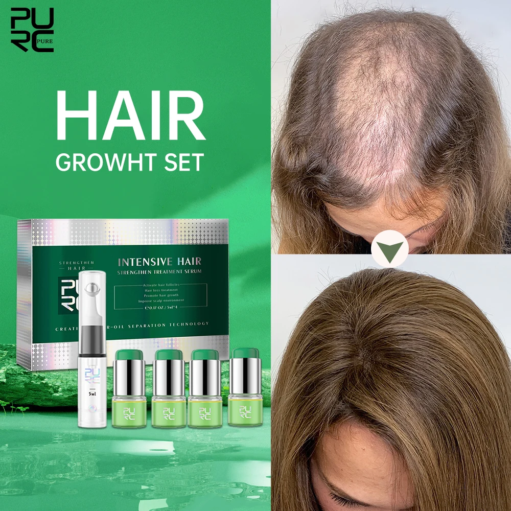 

PURC Rosemary Oil For Hair Growth Anti Hair Loss Ginger Serum Fast Regrowth Scalp Treatment Hair Care Products for Men Women