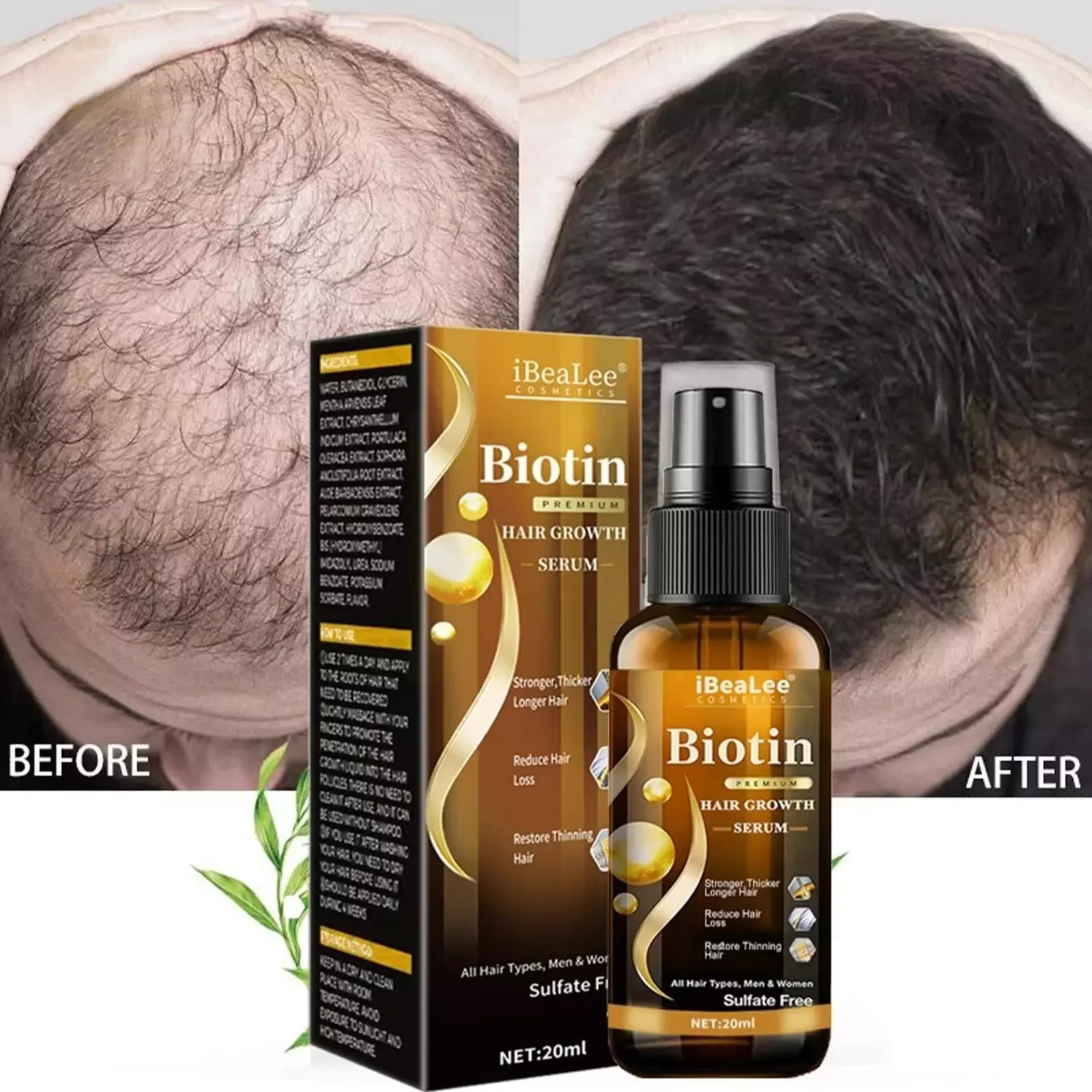 

NEW IN iBeaLee Hair Growth Products Biotin Fast Growing Hair Essential Oil Hair Care Prevent Hair Loss Scalp Treatment For Men W