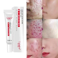 30g azelaic acne removal cream remove acne spots surgical scars treatment shrink pores smooth whitening beauty cosmetics