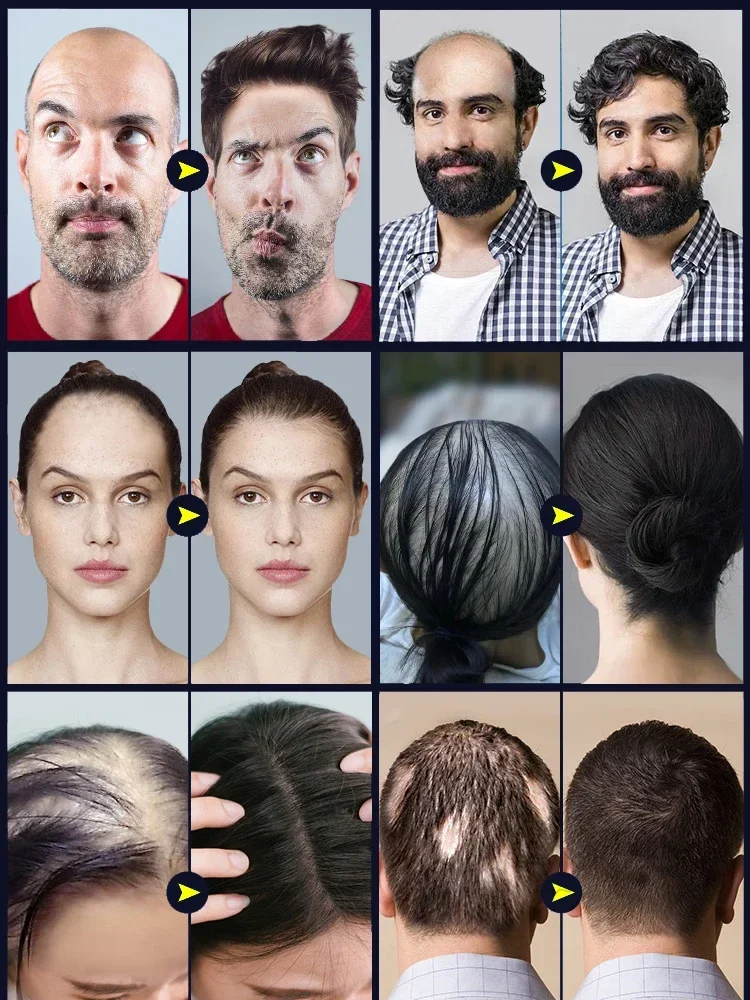 Biotin быстрое масло для роста волос сыворотка восстановления лечение истончения