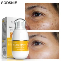 whitening freckle cream remove chloasma cream dark spots sunburn age spots brighten skin anti aging vitamin c skin care 40g