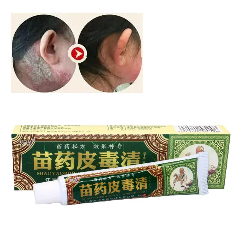 

Skin DermatiTis Cream Dermatitis Anti Fungal Infection Chinese Herb Medical Skin CarePsoriaOintmentRepairsis