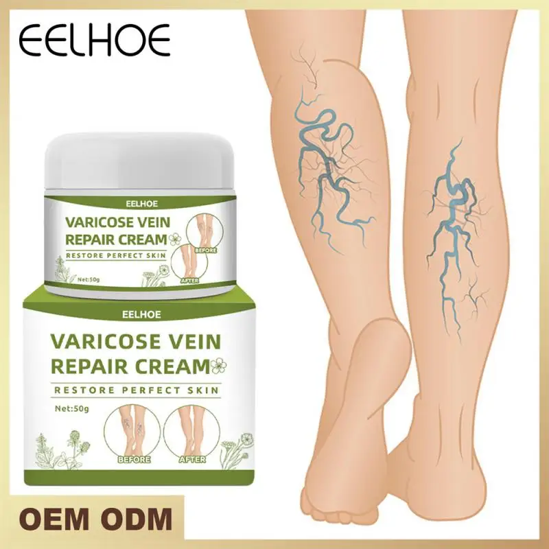 Varicose Vein Repair Cream Repair Spray Relieve Leg Pain Swelling Improve Leg Earthworm Varicose Bulge Boost Blood Circulation