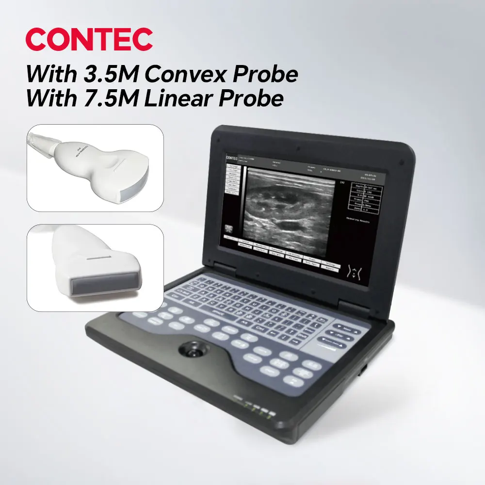 

Contec Цифровой Портативный Ультразвуковой Сканер CMS600P2