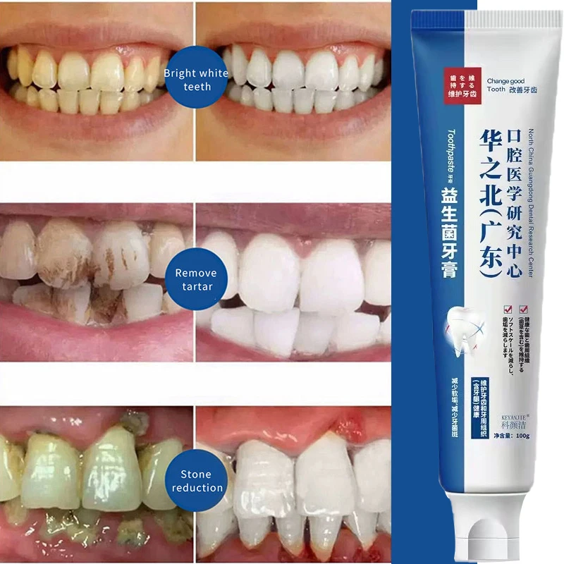 

2023 New Quick Repair of Cavities Caries Removal of Plaque Stains Decay Whitening Yellowing Repair Teeth Teeth Whitening 100g