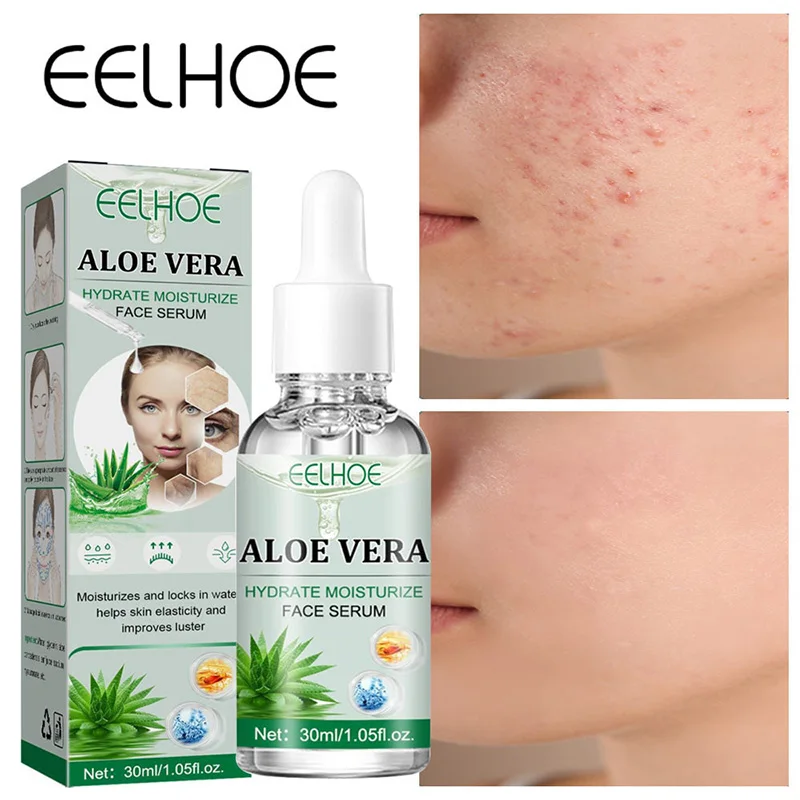 

Aloe Vera Acne Treatment Face Serum Wrinkles Removal Shrink Pores Whitening Brighten Moisturizer Nourish Repair Beauty Skin Care