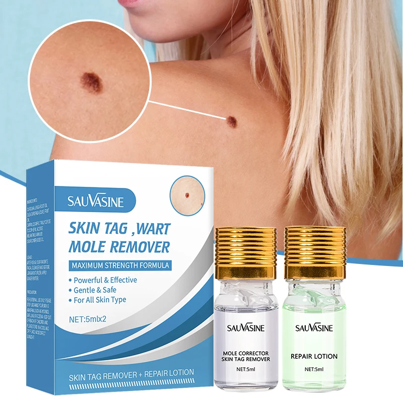 

Wart Sets Removing Against Moles Remover Anti Verruca Remedy Liquid Treatment Papillomas Removal Of Warts Liquid From Skin Tags