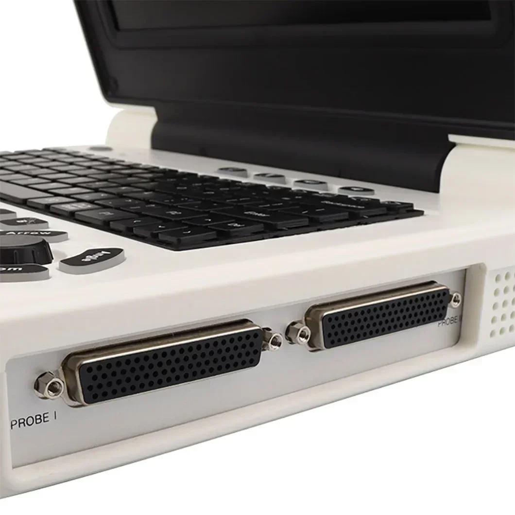 Kliniek Ziekenhuis Ob/Gyn Ноутбук Draagbare Ультразвуковая система Prijs Van машина