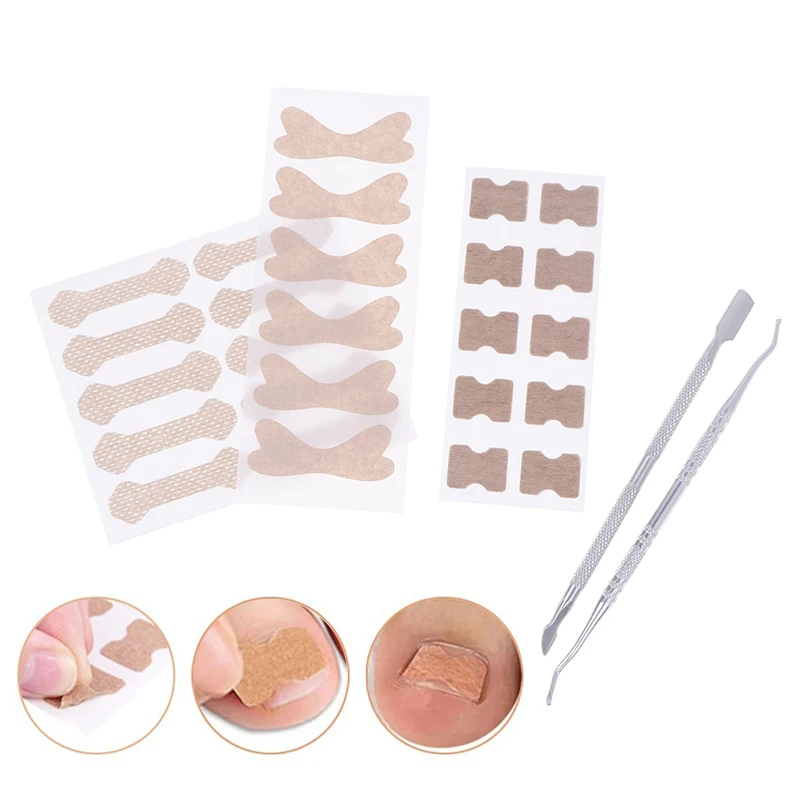 10 шт. набор наклеек для коррекции вросших ногтей клейкий пластырь эластичный