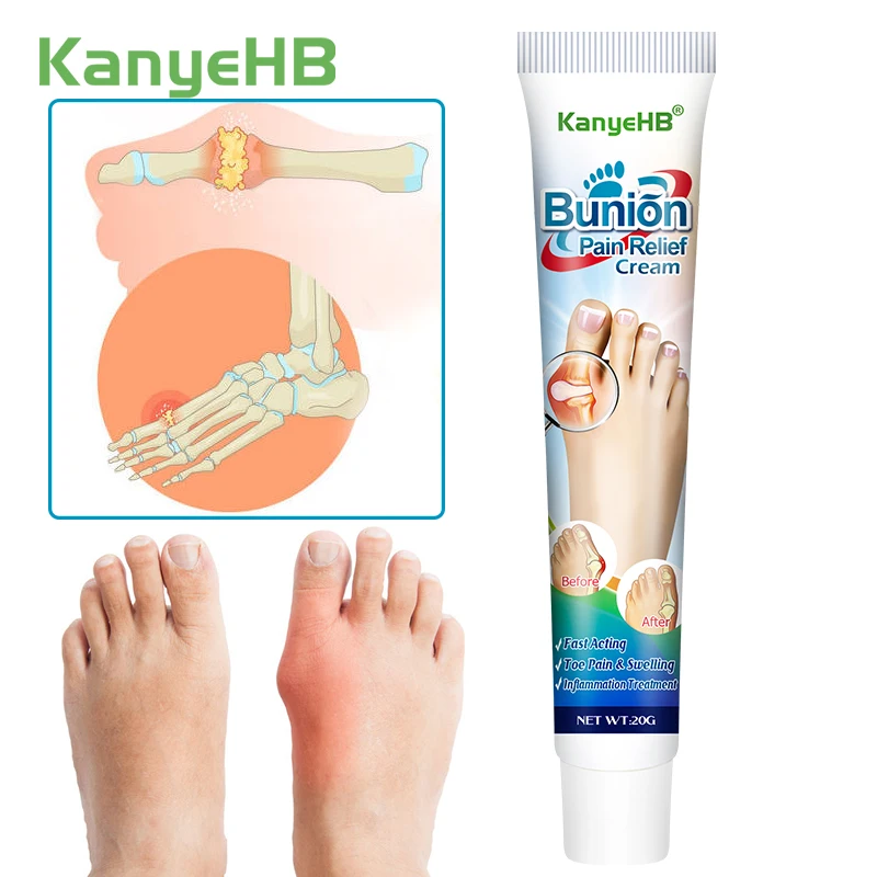

1Pcs Joint Pain Cream Bunion Gout Joint Valgus Arthritis Treatment Ointment Relief Stiffness Inflammation Toe Swell Cream G019