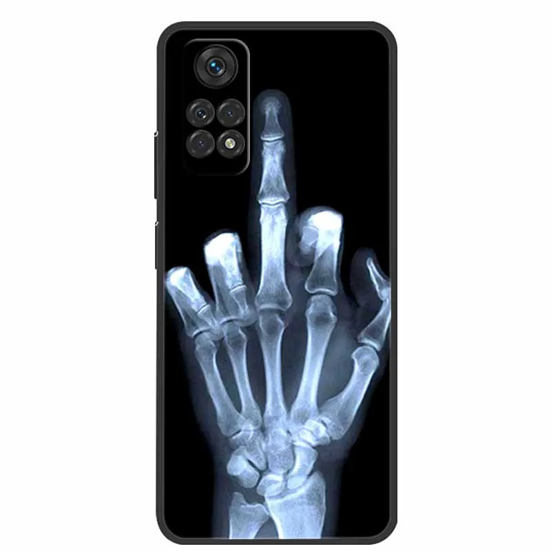 for xiaomi poco m4 pro 4g case 2022 shockproof silicone soft tpu phone cover for poco m4 pro 6 43 case bumper m4pro fundas etui free global shipping