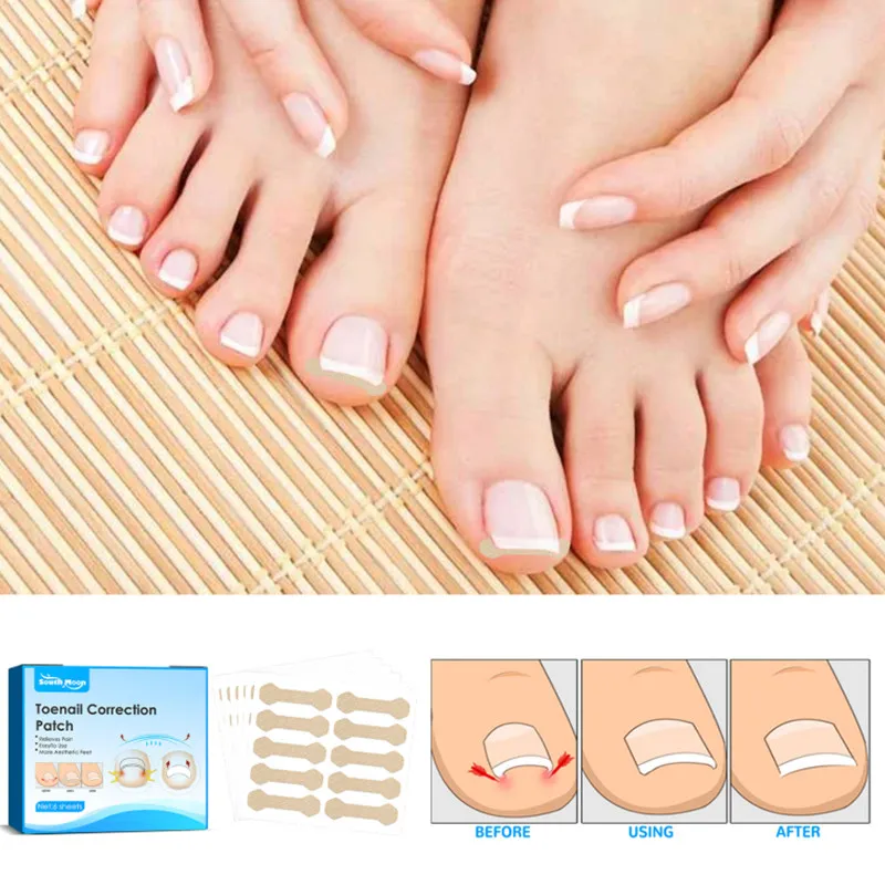 

6Sheets Nail Paste Paronychia Nail Corrector Toenail Correction Sticker Nail Groove Ingrown Manicure Repair Patch Feet Care Tool