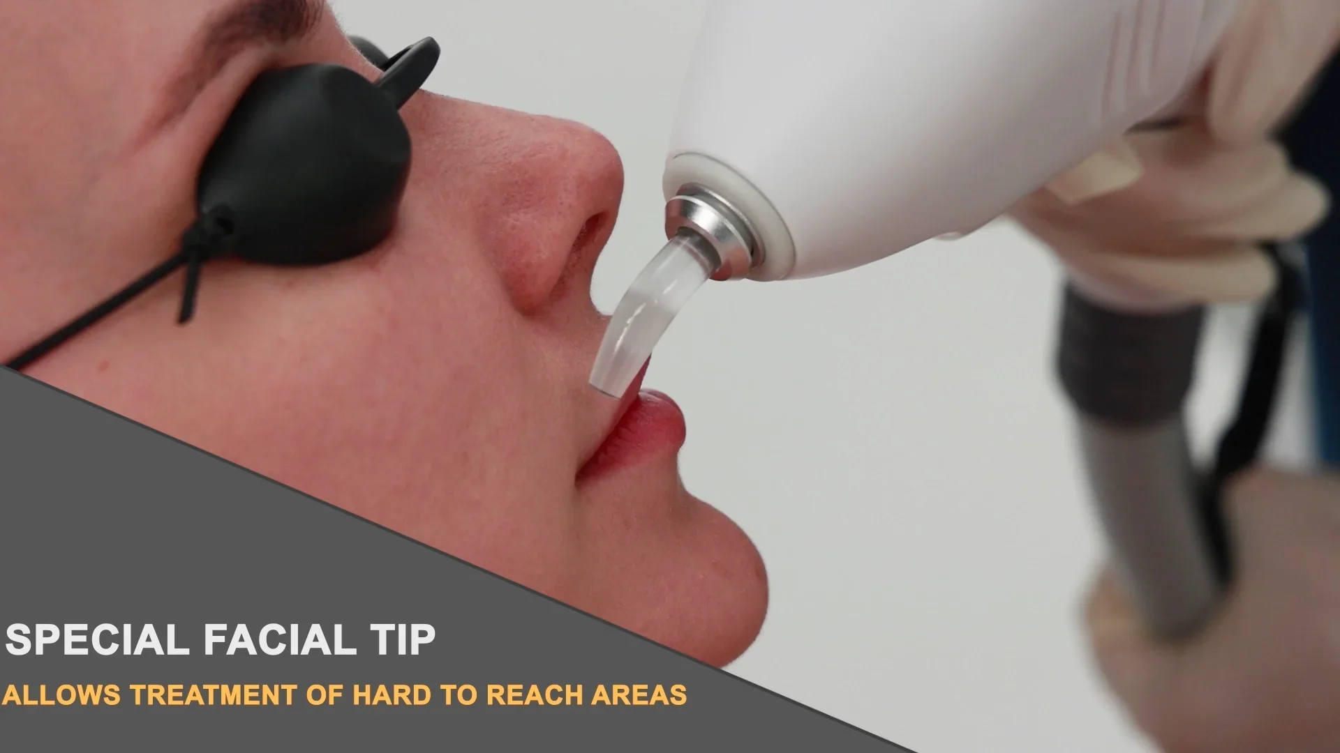 Рисунок 2 - Профессиональный нм и нм