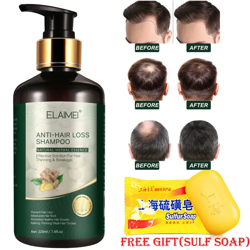 

220ml Chinese Herbal Ginger Hair Growth Shampoo Anti Hair Loss Shampoo Regrowth Hair Repair Prevent Product Hair Loss Treatment