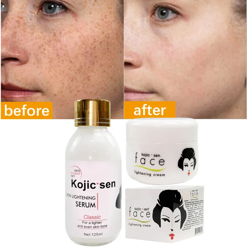 

2pcs Kojic Concentre Kojic Acid Cream Strong Brightening Fade Stubborn Dark Spots Radiant Even Complexion Face Serum