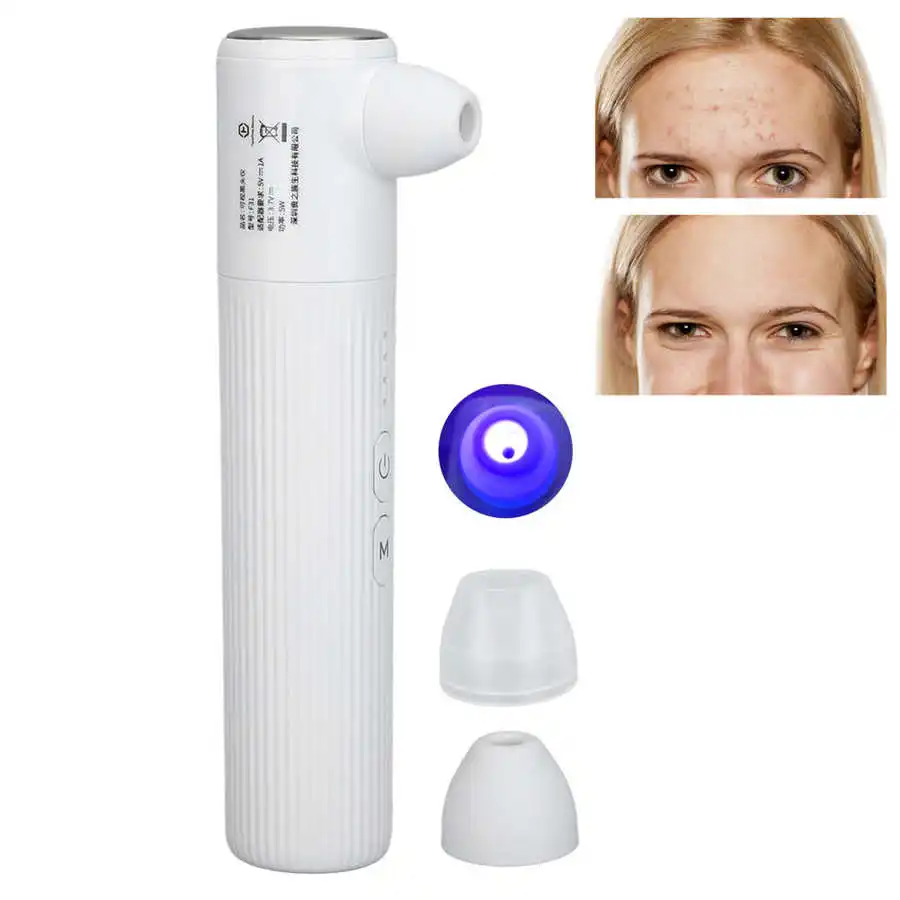 Пылесос для удаления черных точек инструмент терапии сисветильник салона