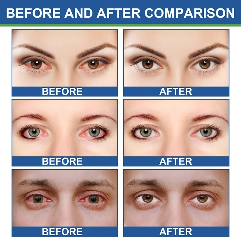 Новая мазь для защиты глаз смягчения и сушки восстанавливает эластичность