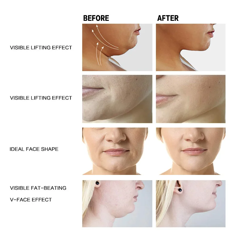 Крем для лица против старения, невидимый, разглаживающий морщины, укрепляющий и подтягивающий кожу V-образной формы (art.: 3920d8e0edc91) - 3920d8e0edc91